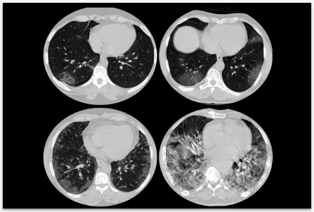 Projeto Predição de Risco Cirúrgico